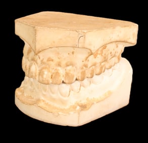 Vintage Dental Mold, Teaching Tool