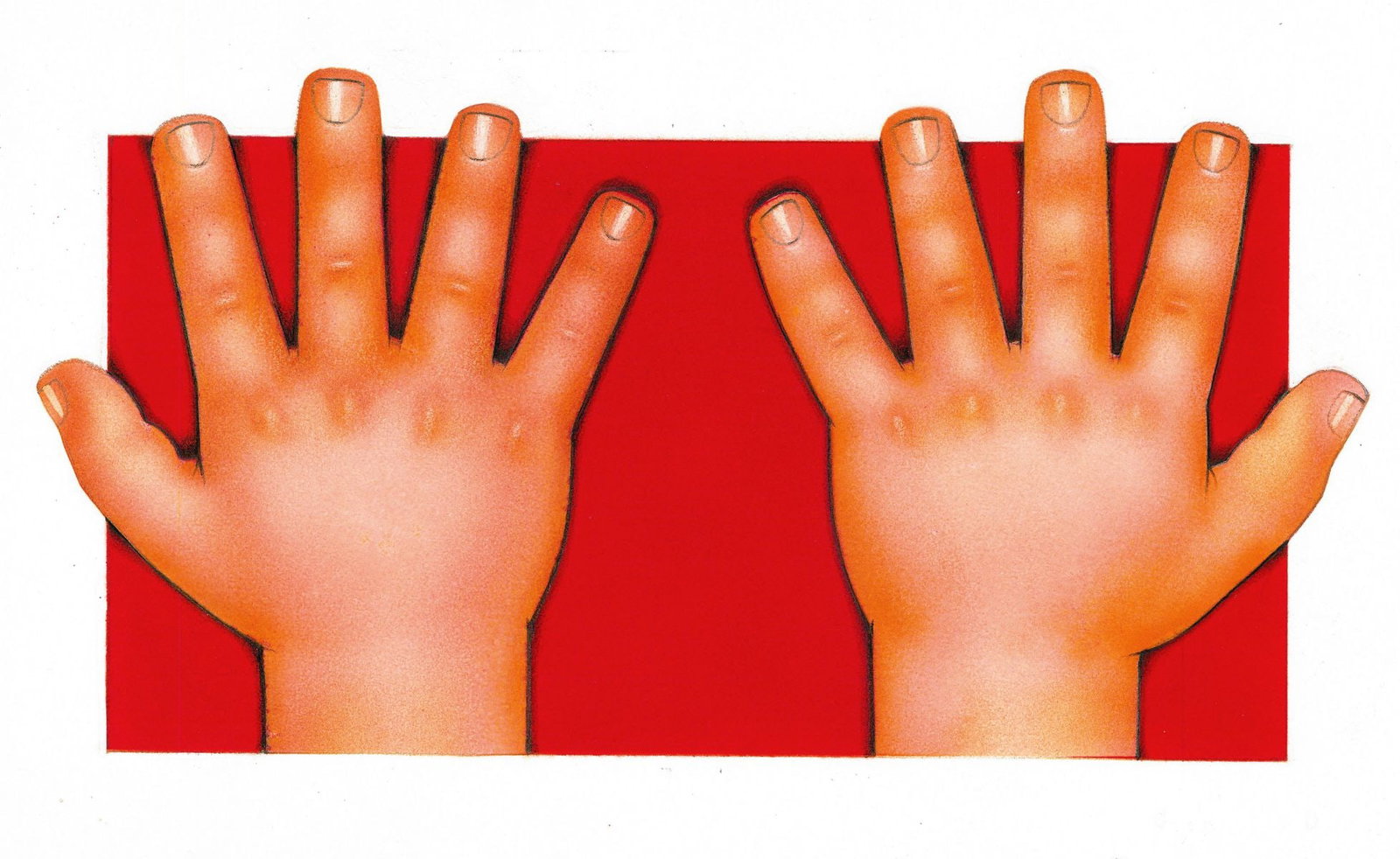Alex Bloch (US,20C) gouache painting: ARTIST: Alex Bloch (American, 20 century) TITLE: Children Hands MEDIUM: gouache on heavy paper CONDITION: Minor damages to upper corners. Minor age toning. ART SI