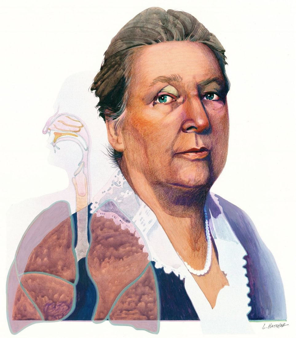 Lois Hatcher (US,1946-?) mixed media painting: ARTIST: Lois Hatcher (American, 1946 - ???) TITLE: Portrait of Emily Bissell (titled on verso) YEAR: 1980 MEDIUM: mixed media on board CONDITION: Some