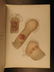 1889 1ed Morrow Medical Atlas Skin & Venereal Diseases - 10