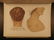 1889 1ed Morrow Medical Atlas Skin & Venereal Diseases - 2