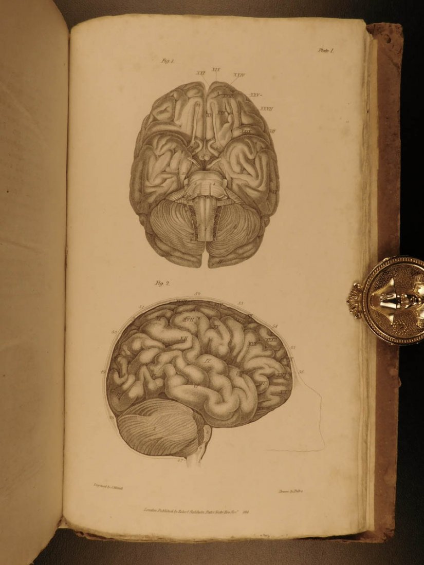 1815 1ed Neurology Brain Anatomy Spurzheim & Gall: 1815 1ed Neurology Brain Anatomy Spurzheim & Gall Physiognomy Phrenology Johann Spurzheim was a notable Germany physician who was one of the most notable 19th-century doctors, along with Franz Gall, t