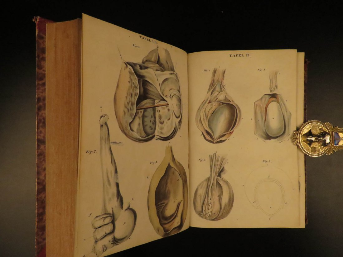 1837 Astley Cooper Surgery Atlas Human Anatomy German (1 of 10)