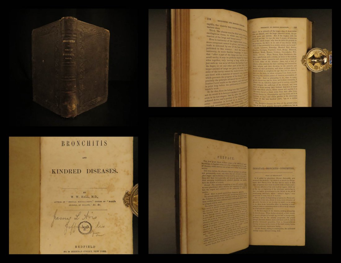 1856 Bronchitis by Hall CIVIL WAR Provenance: 1856 Bronchitis by Hall CIVIL WAR Provenance Confederate Medicine Virginia CSA ‘Bronchitis and Kindred Diseases’ is a rare mid-19th-century medical text designed to teach physicians and students a
