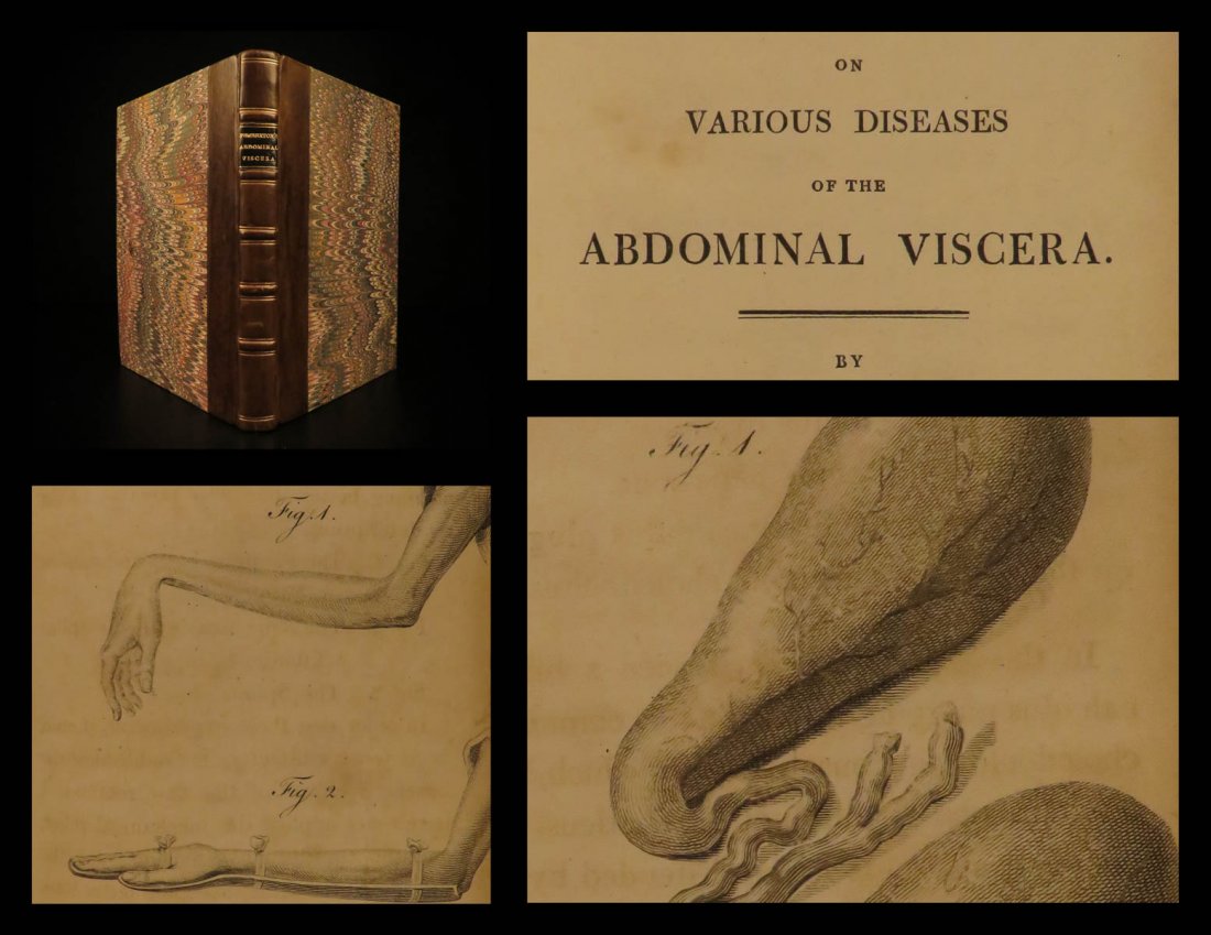 1807 MEDICINE & Surgery Pemberton on Viscera Disease (1 of 10)