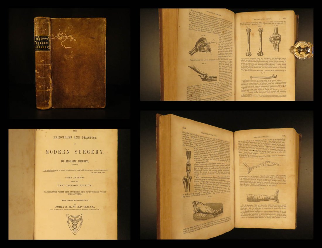 1847 SURGERY Principles & Practice Robert Druitt Human: 1847 SURGERY Principles & Practice Robert Druitt Human Anatomy Medicine RARE Robert Druitt was a 19th-century English author, best-known for his medical treatises. One of his medical works was ‘The 