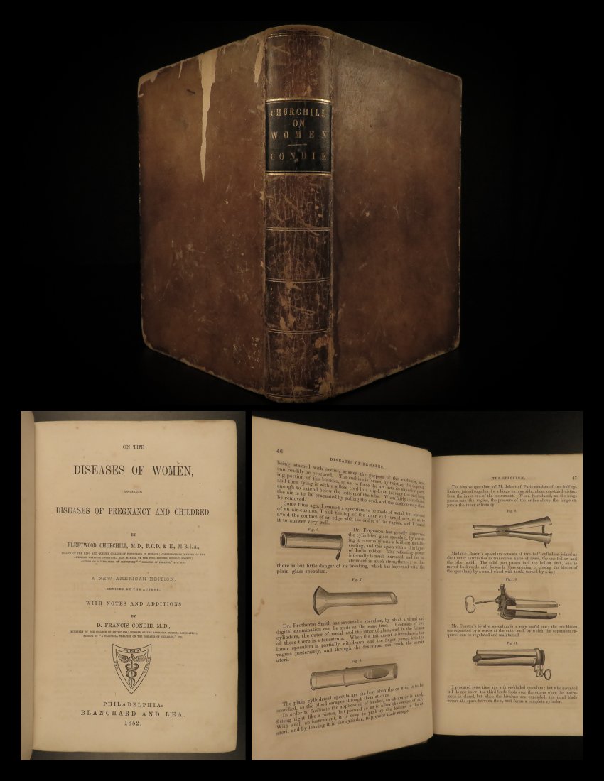 1852 Diseases of Women Medicine Speculum Obstetrics: 1852 Diseases of Women Medicine Speculum Obstetrics Pregnancy OBGYN Pediatrics Fleetwood Churchill was a 19th-century English physician who is best known for his works on obstetrics and pregnancy. One