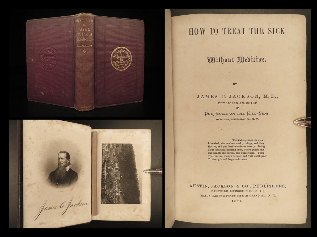 1874 To Treat Sick Without Medicine Healthy Living Diseases Hygiene Exercise: 1874 To Treat Sick Without Medicine Healthy Living Diseases Hygiene Exercise James Jacksons â€œHow to Treat the Sick Without Medicine” is a rare, 19th-century medical manual on treating dise