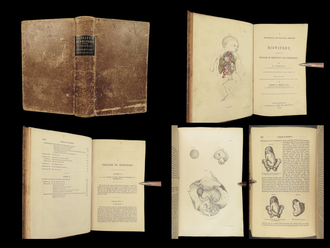 1850 Medicine Cazeaux Treatise Midwifery Childbirth Pregnancy OBGYN Obstetrics (1 of 10)