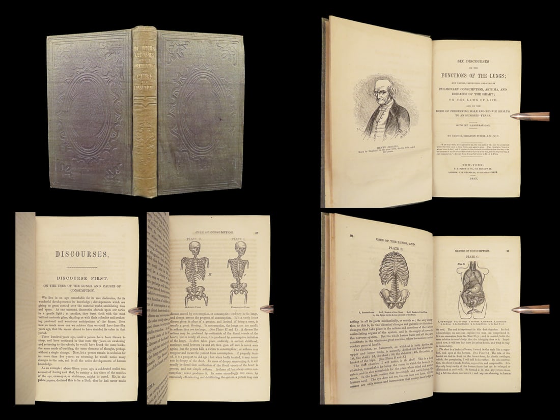 1855 Medicine Sam Fitch on LUNGS Pulmonary Diseases Human Anatomy Asthma Illust: 1855 Medicine Sam Fitch on LUNGS Pulmonary Diseases Human Anatomy Asthma Illust Samuel S Fitch was a 19th-century American physician who is best remembered for his practices and studies in lungs and p
