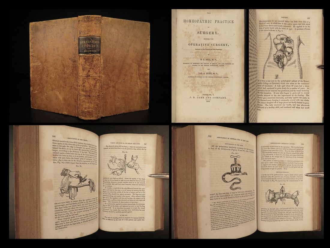 1855 Homeopathy SURGERY Pseudoscience Alternative Medicine Herbal Cures Cancer: 1855 Homeopathy SURGERY Pseudoscience Alternative Medicine Herbal Cures Cancer Benjamin Hill and James Hunts “Homeopathic Practice of Surgery” is a 19th-century attempt to qualify homeopathy a