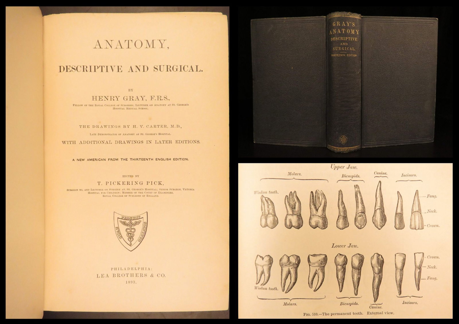 1893 – Gray’s Anatomy – Henry Gray | Famous Medicine & Surgery Text, Illustrated (1 of 10)
