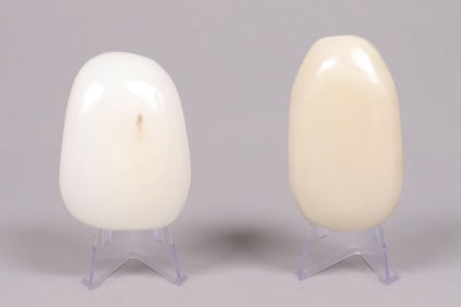 Lots Chinese pebbles