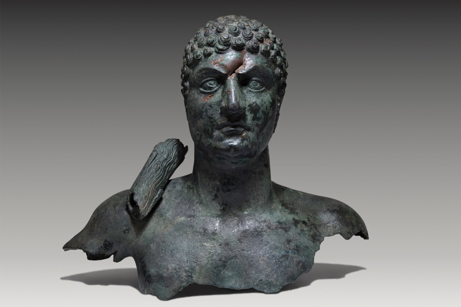 LARGE ROMAN BRONZE BUST OF AN EMPEROR AS HERAKLES WITH CLUB: Ca. AD 150 - 220. A bronze bust of an emperor (probably Caracalla or Commodus) depicted as Herakles, with a broad chest and long neck, the head turned slightly to the left. The broad youthful face is 