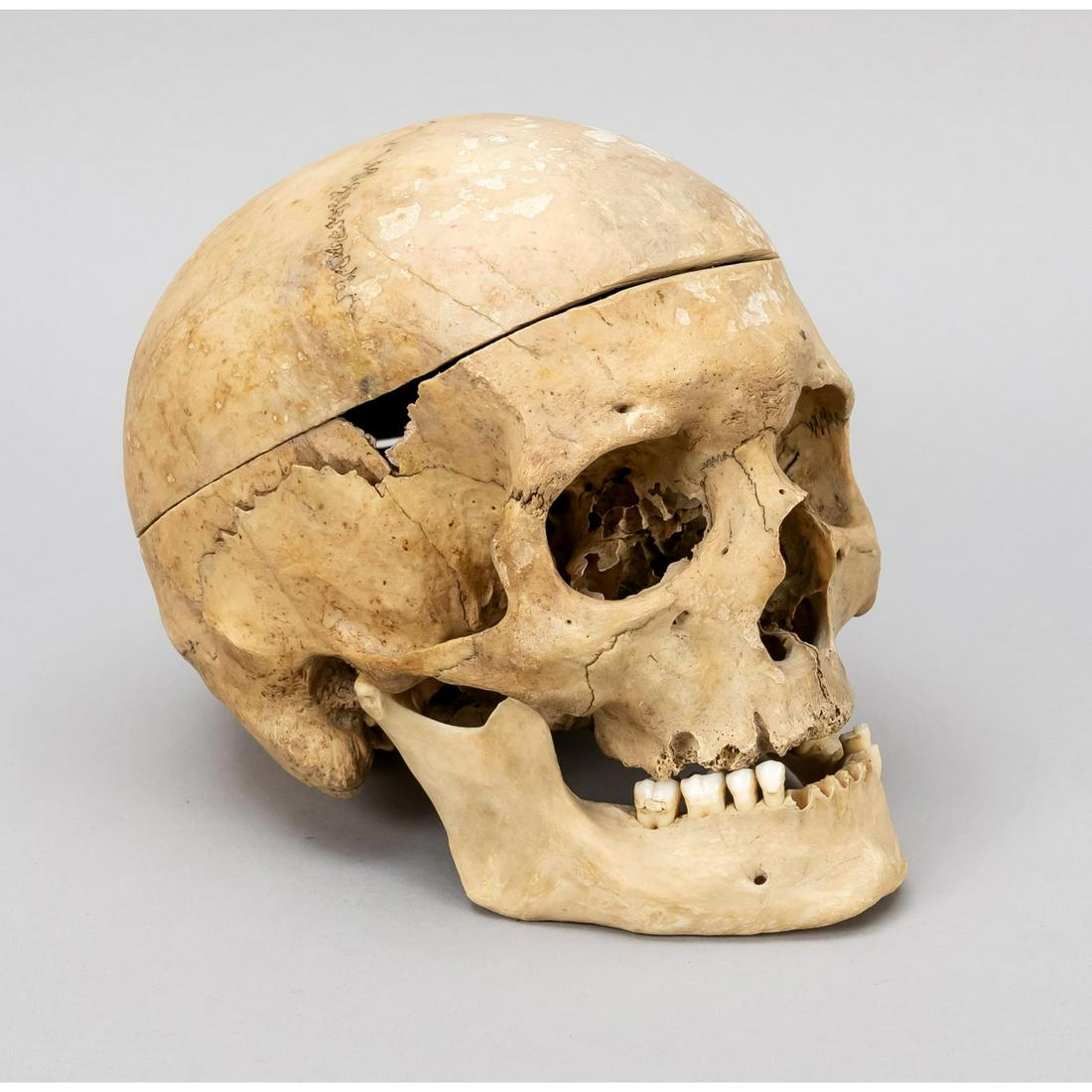 Skull of a Homo Sapiens, proba (1 of 1)