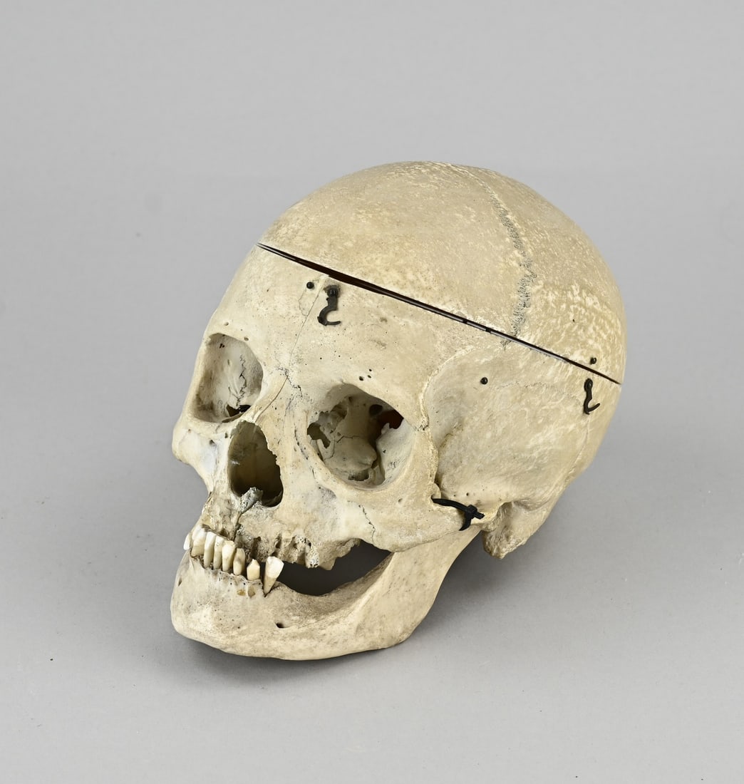 Human skull, 1900: Antique human skull, opens with a brass hook lock. Circa 1900. Dimensions: 20 x 13 x 18 cm. In good condition.