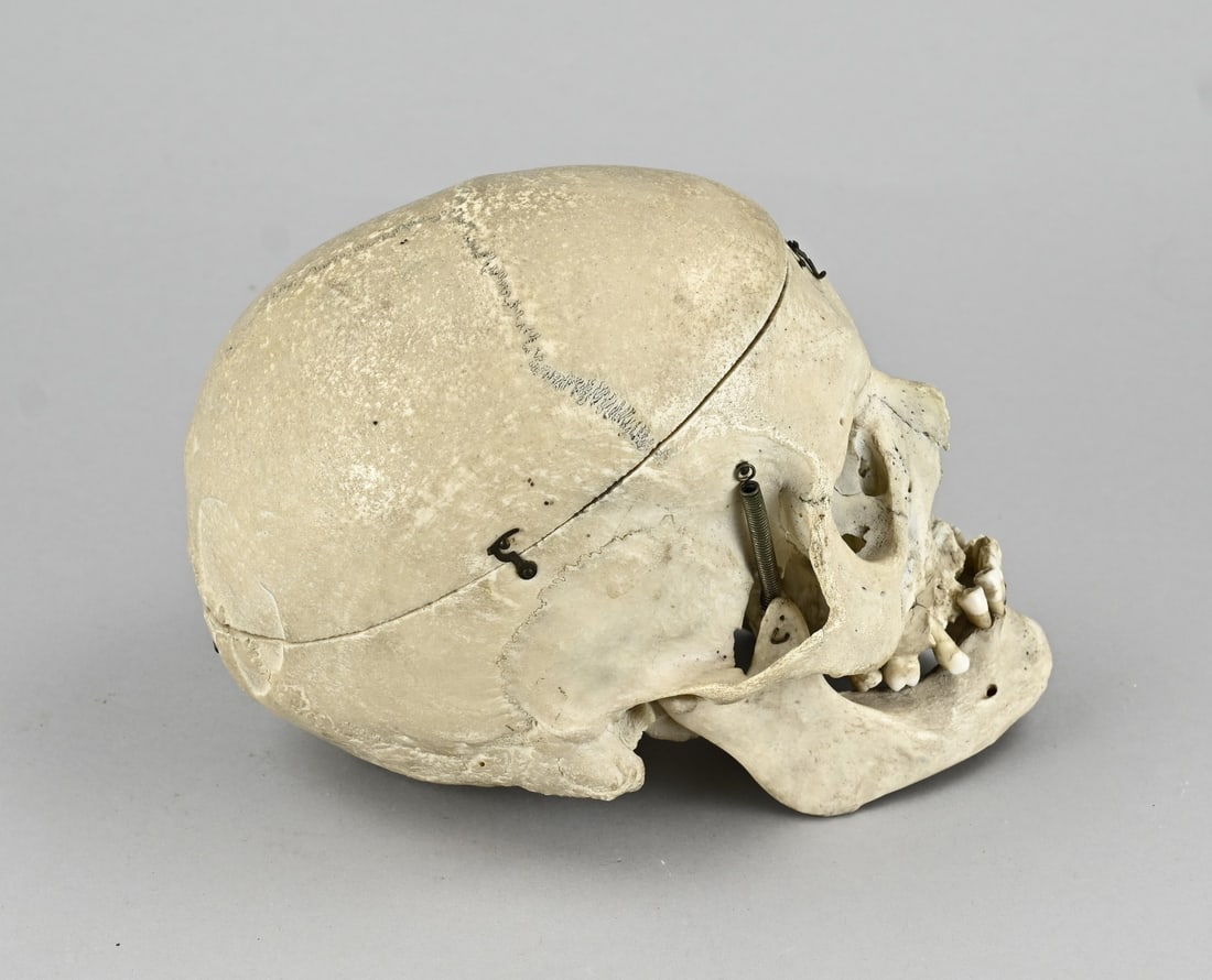 Human skull, 1900 - 2