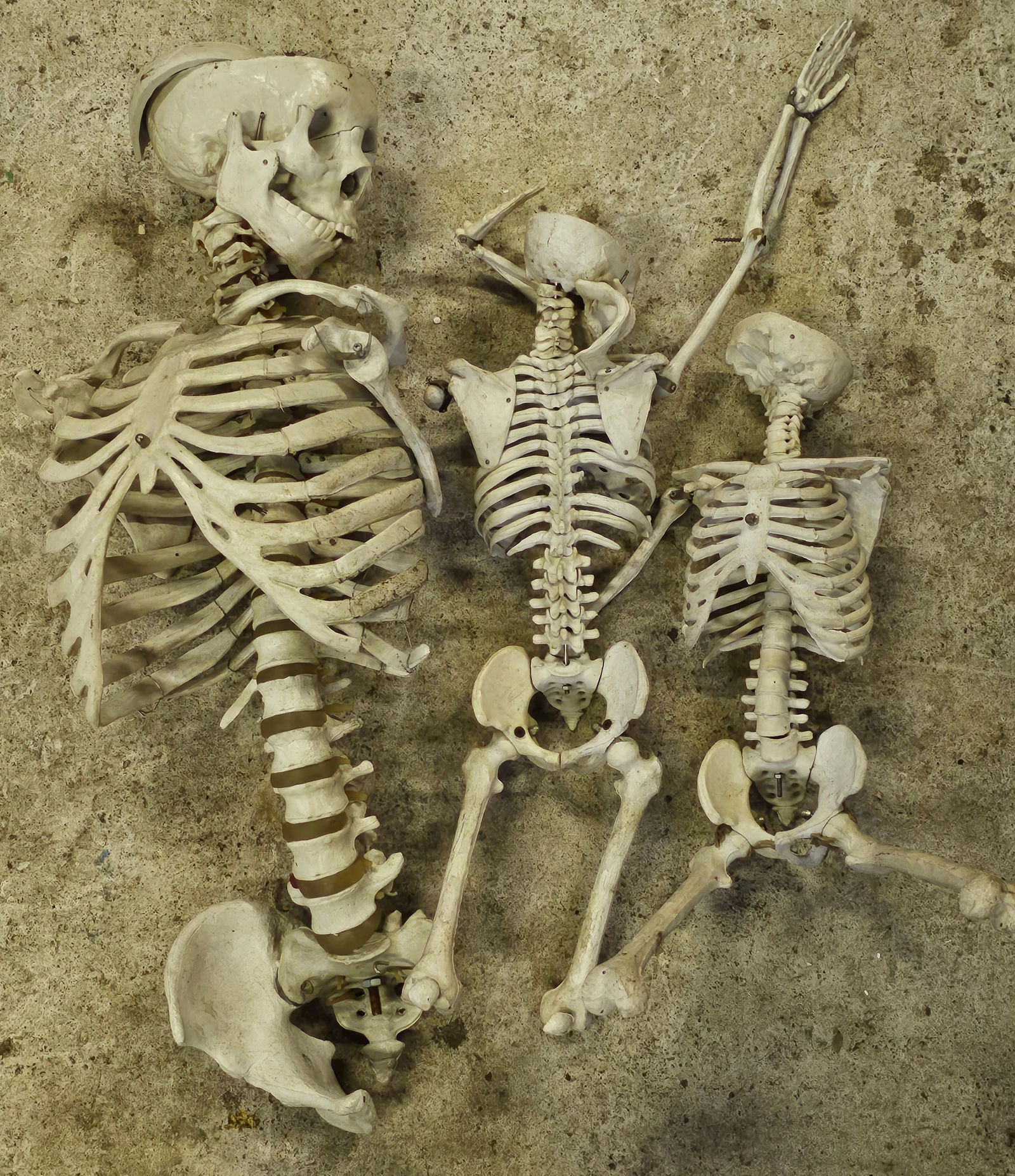 Partial Vintage Skeleton Anatomical Models (1 of 3)