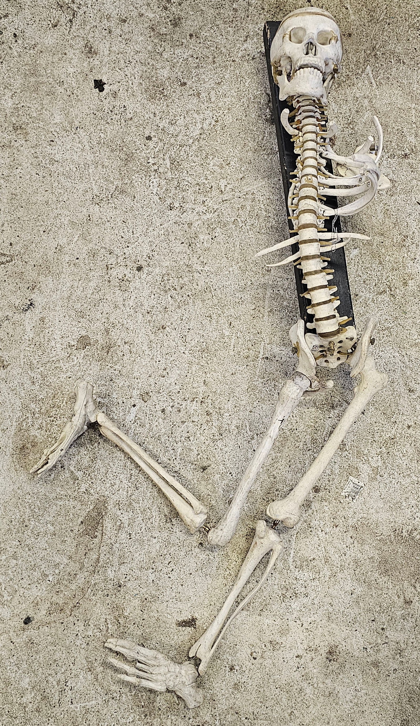 Vintage Partial Mounted Skeleton Model (1 of 2)
