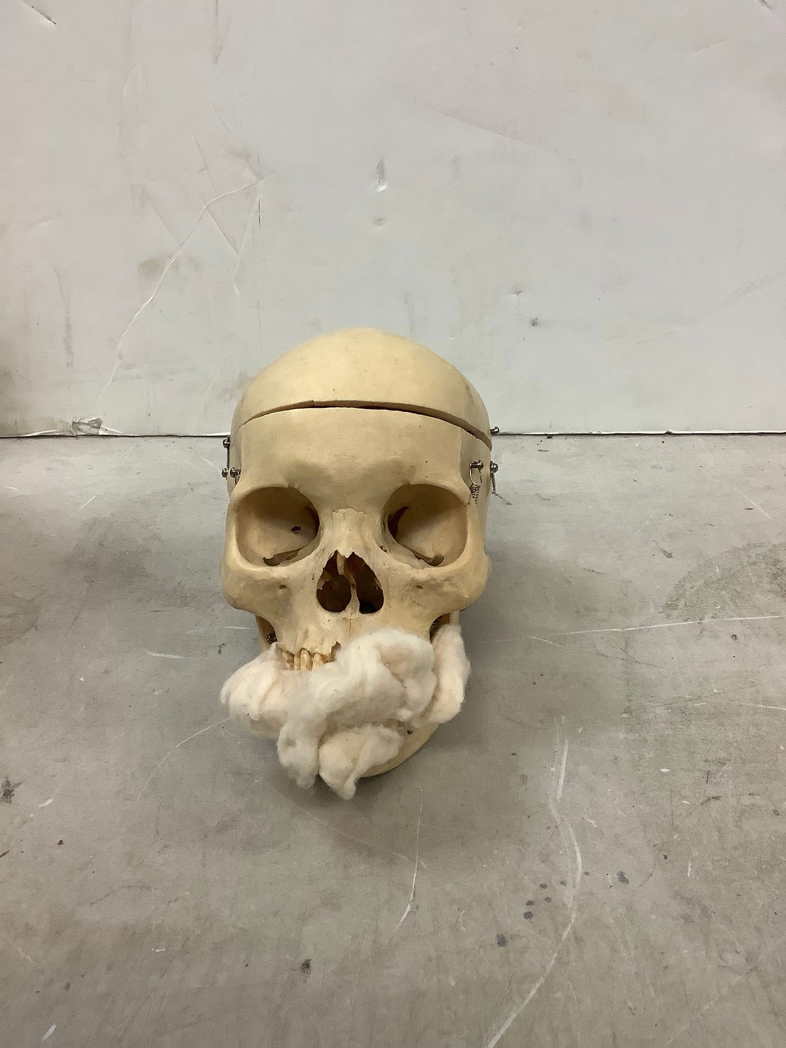 Anatomy skull (1 of 1)