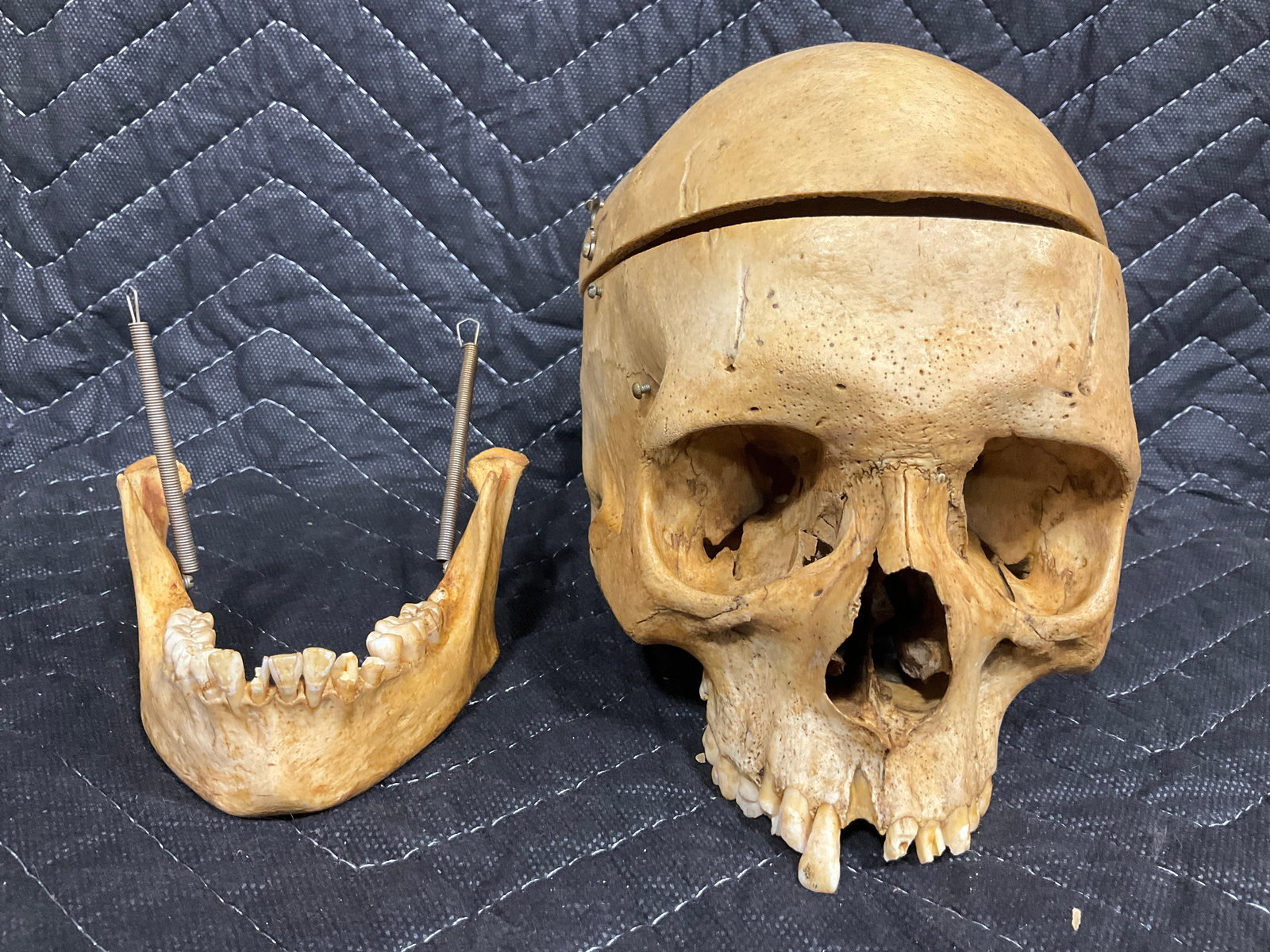 Real human skull (1 of 1)