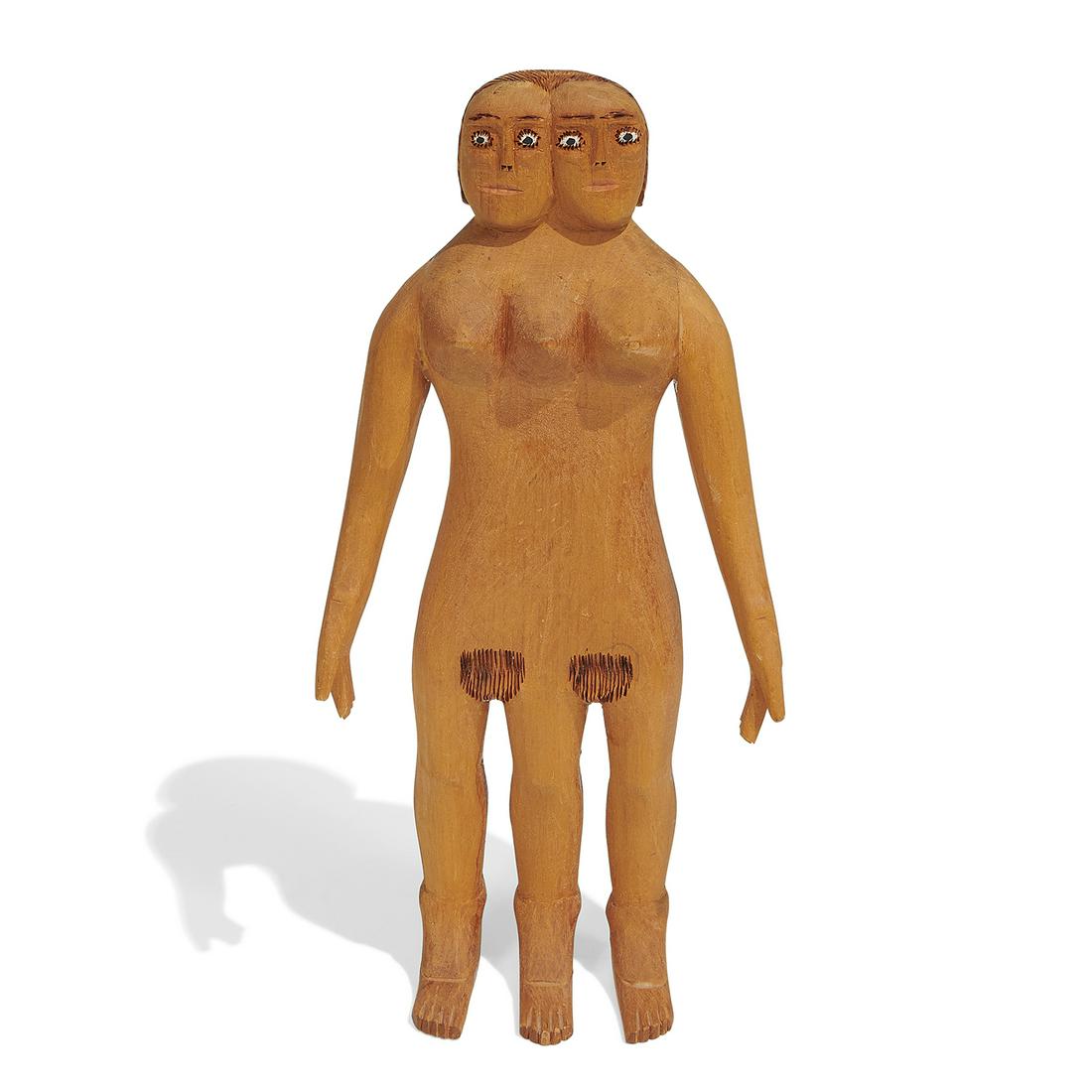 Sulton Rogers, Conjoined Female Twins (1 of 6)