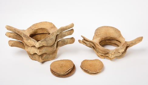 Group of Whale Vertebrae
