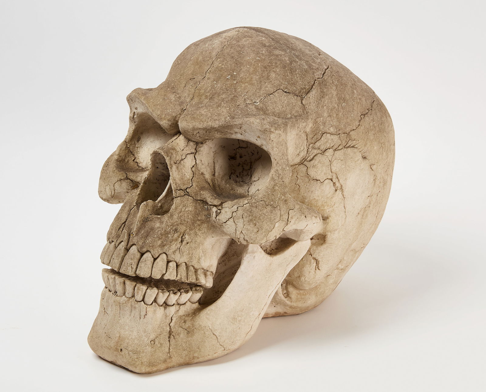 Oversized Human Skull (1 of 5)