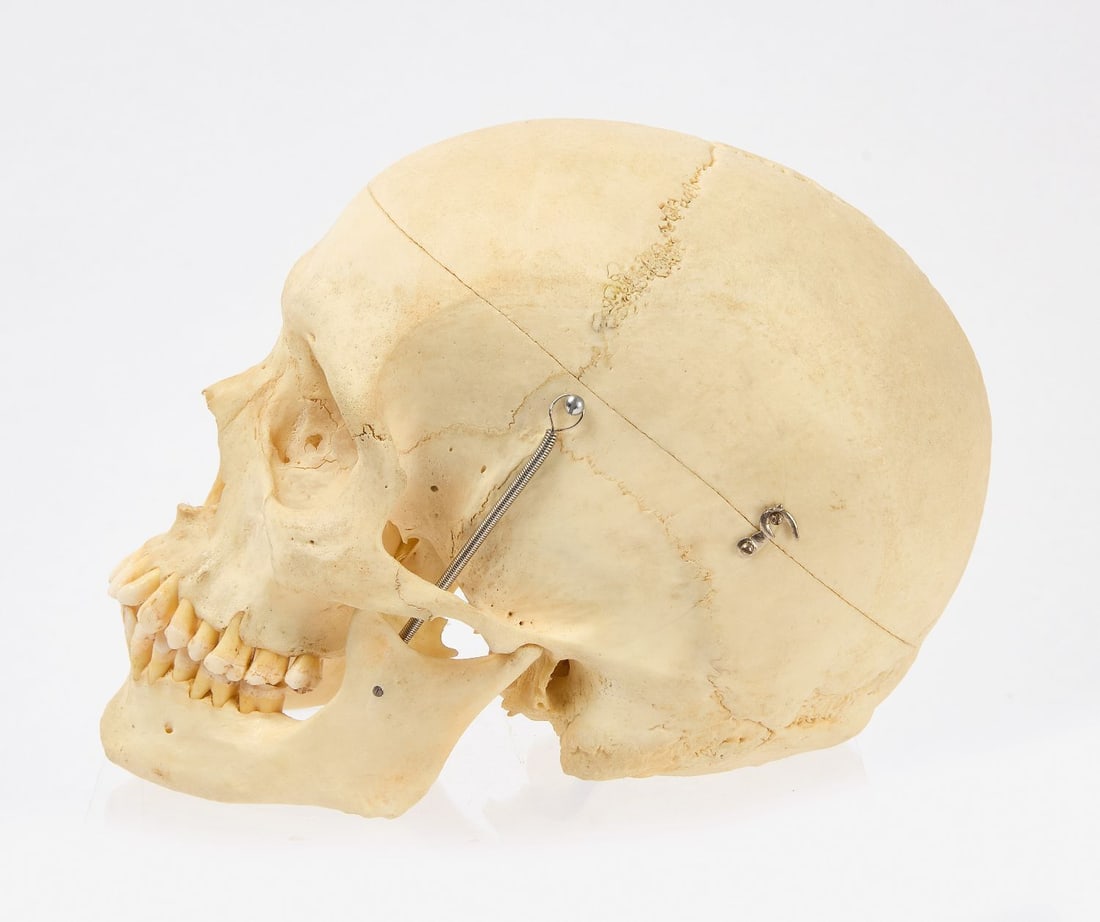 Clay Adams Human Skeleton with Case - 4