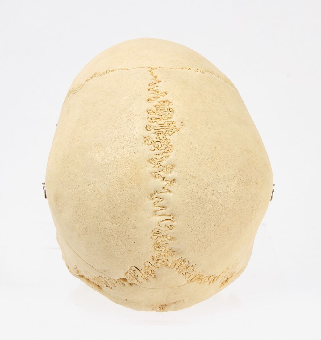 Clay Adams Human Skeleton with Case - 5