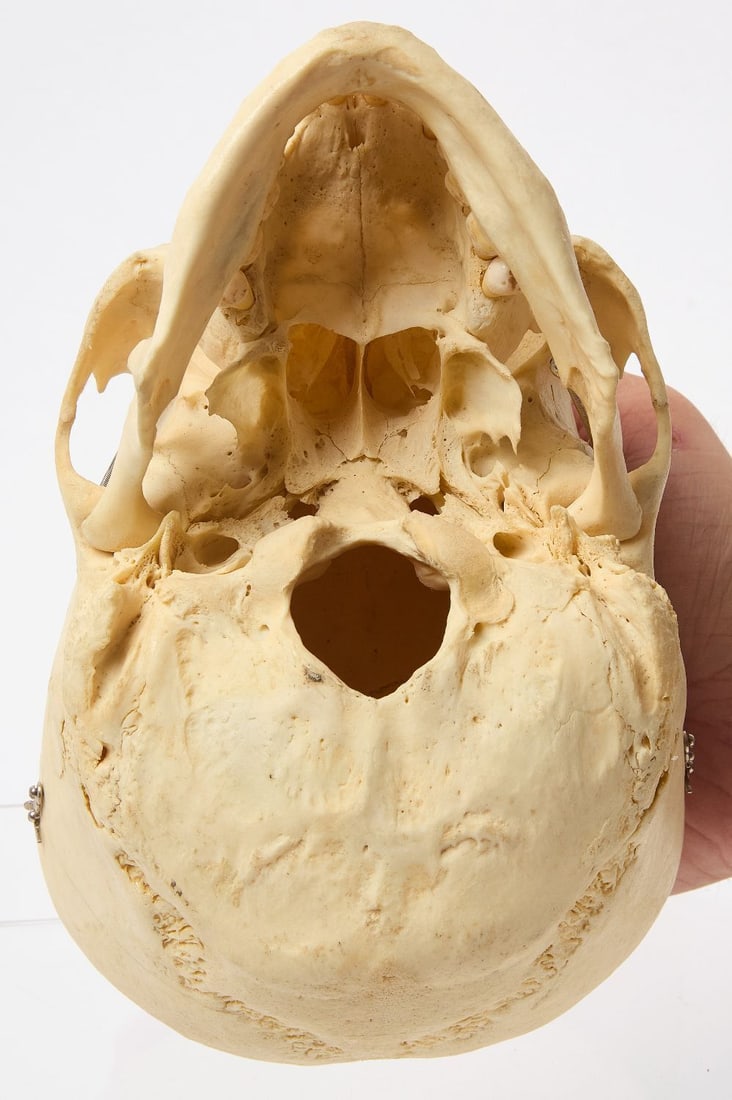 Clay Adams Human Skeleton with Case - 7