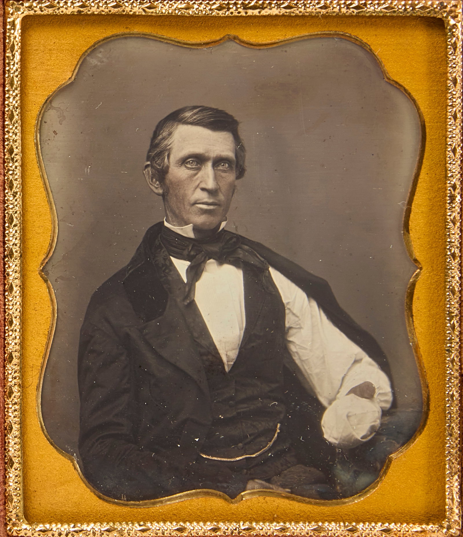Daguerreotype Portrait of an Identified Amputee (1 of 3)