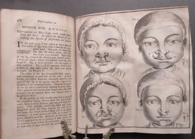 Memoirs of Royal Academy of Surgery Paris, 2vol. 1st UK Ed. 1750 illustrated, Plates