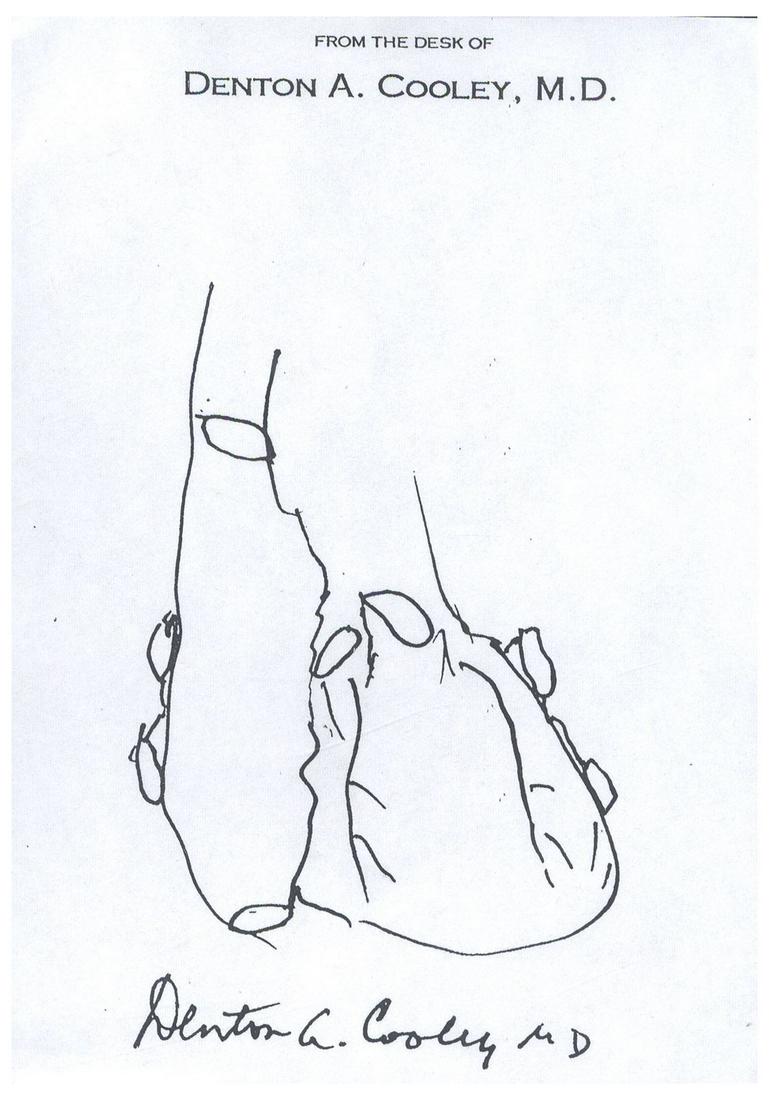 Dr. Denton Cooley Signed Sketch of Human Heart (1 of 1)