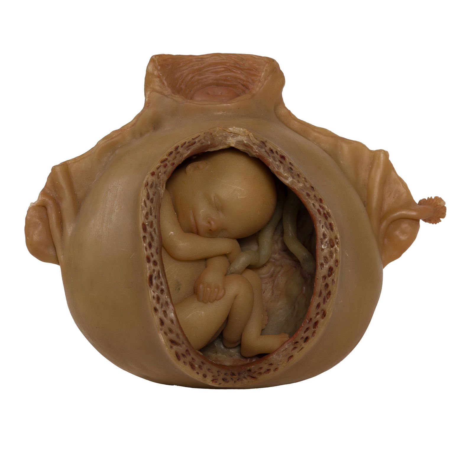 19th Century Wax Anatomical Model Fetus (1 of 7)