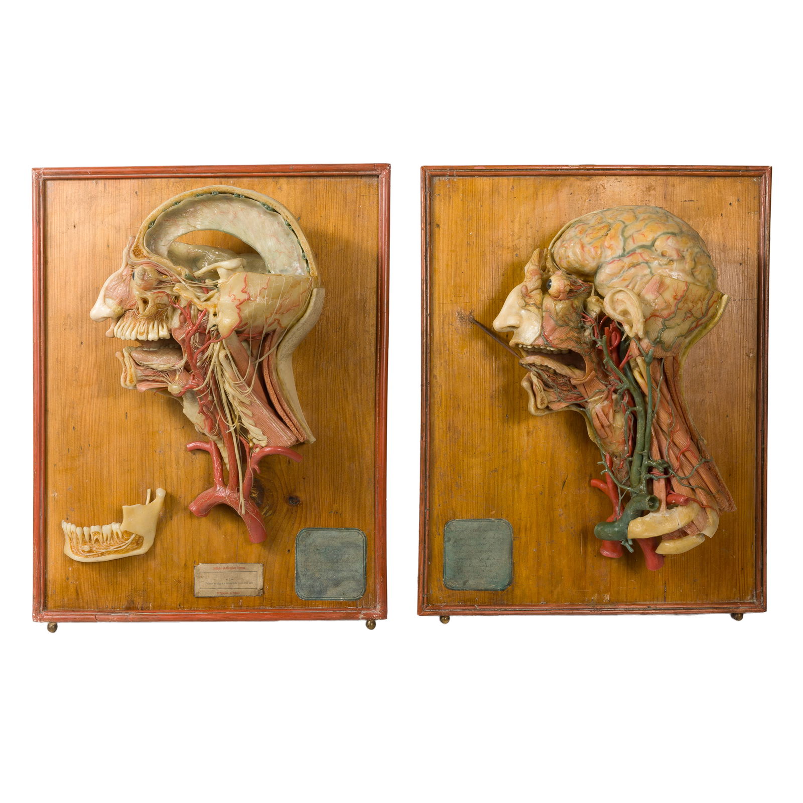 Two Wax Anatomical Models of Dissected Heads (1 of 19)