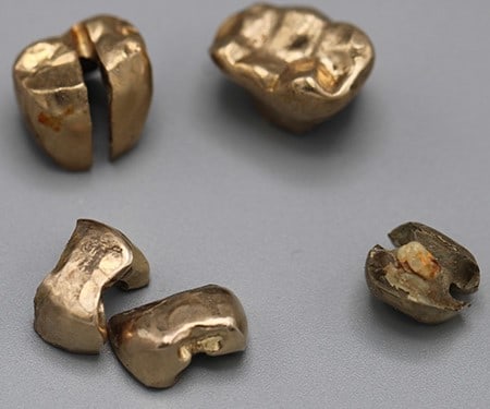 Group of Gold Teeth, Tests at 14K & 18K - 8 Dwt.: Group of Gold Teeth, Tests at 14K & 18K - 8 Dwt. Found in a bag with all the gold. Vermont estate.