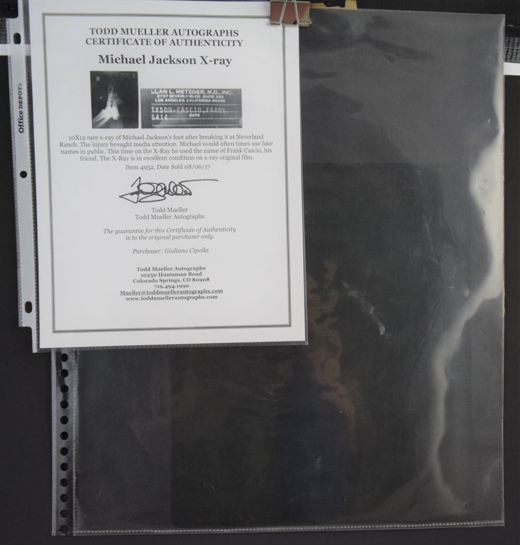 X-Ray of Singer Michael Jackson (1 of 3)