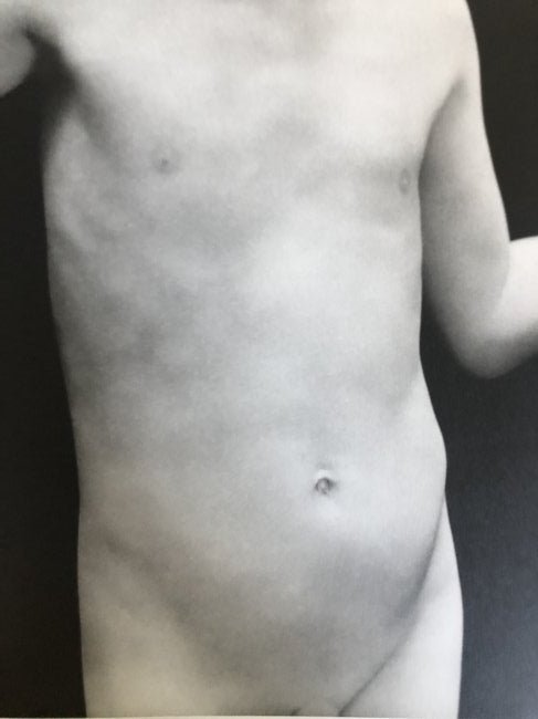 Edward Weston - Neil, 1925: EDWARD WESTON (B.1886-1958) Neil, 1925 Photo-Litho 9.5" x 7.5"