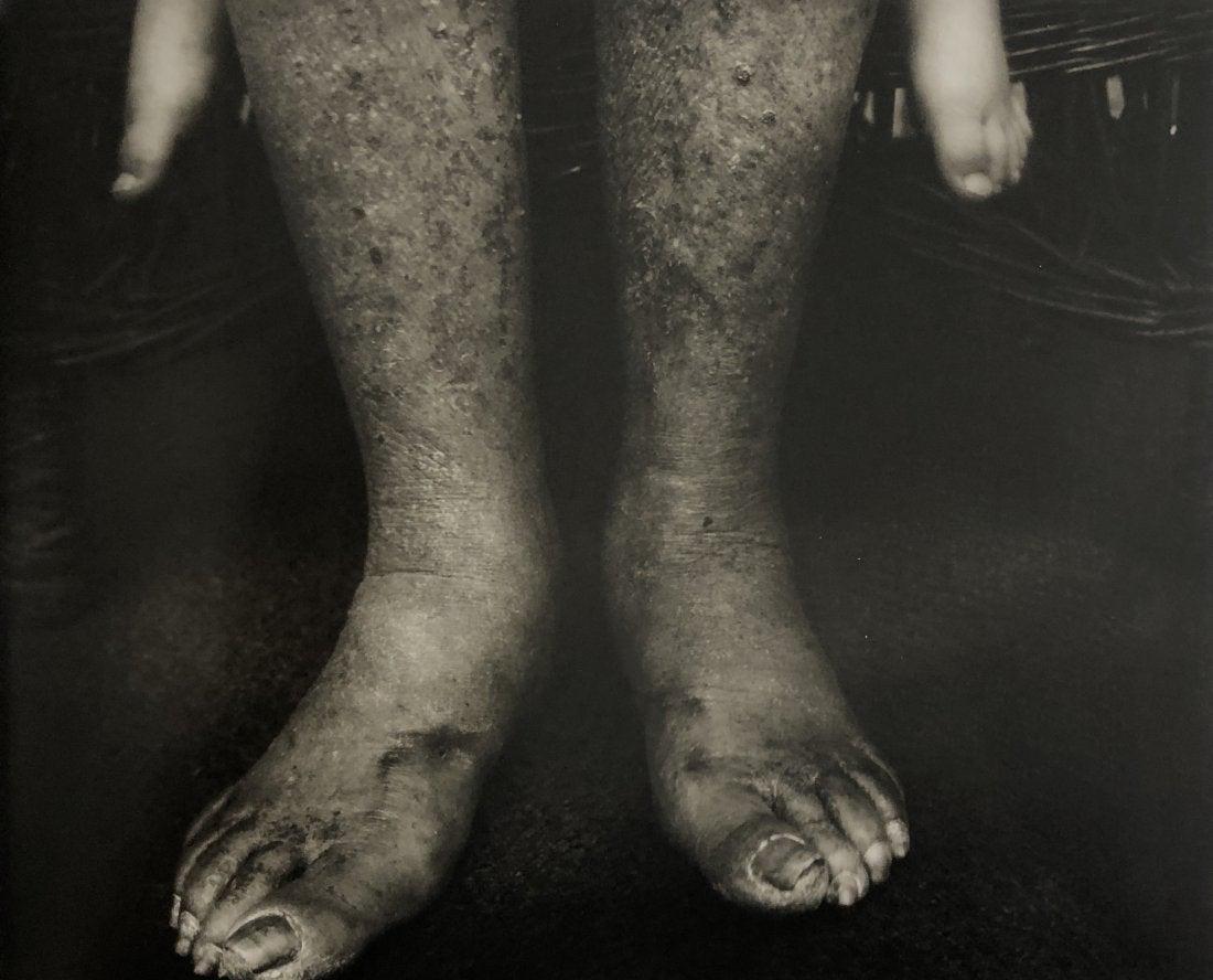 Jock Sturges- Nicholas et Chris;Montalivet, France,1989: JOCK STURGES (B.1947) Nicholas et Christophe; Montalivet, France, 1989 Photo-litho 6 5/8" x 8.5"