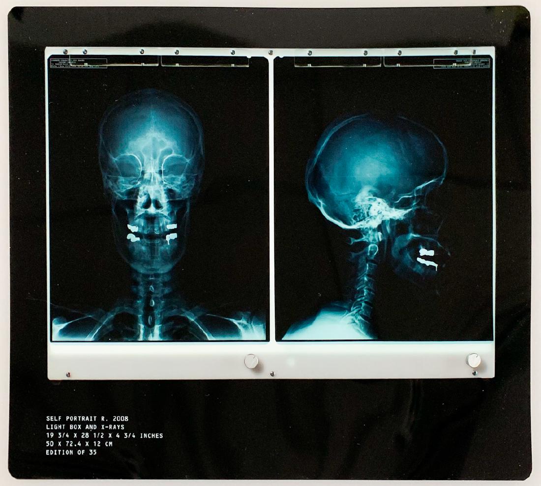 DAMIEN HIRST X-Ray 'Self Portrait' Edition of 35 (1 of 3)