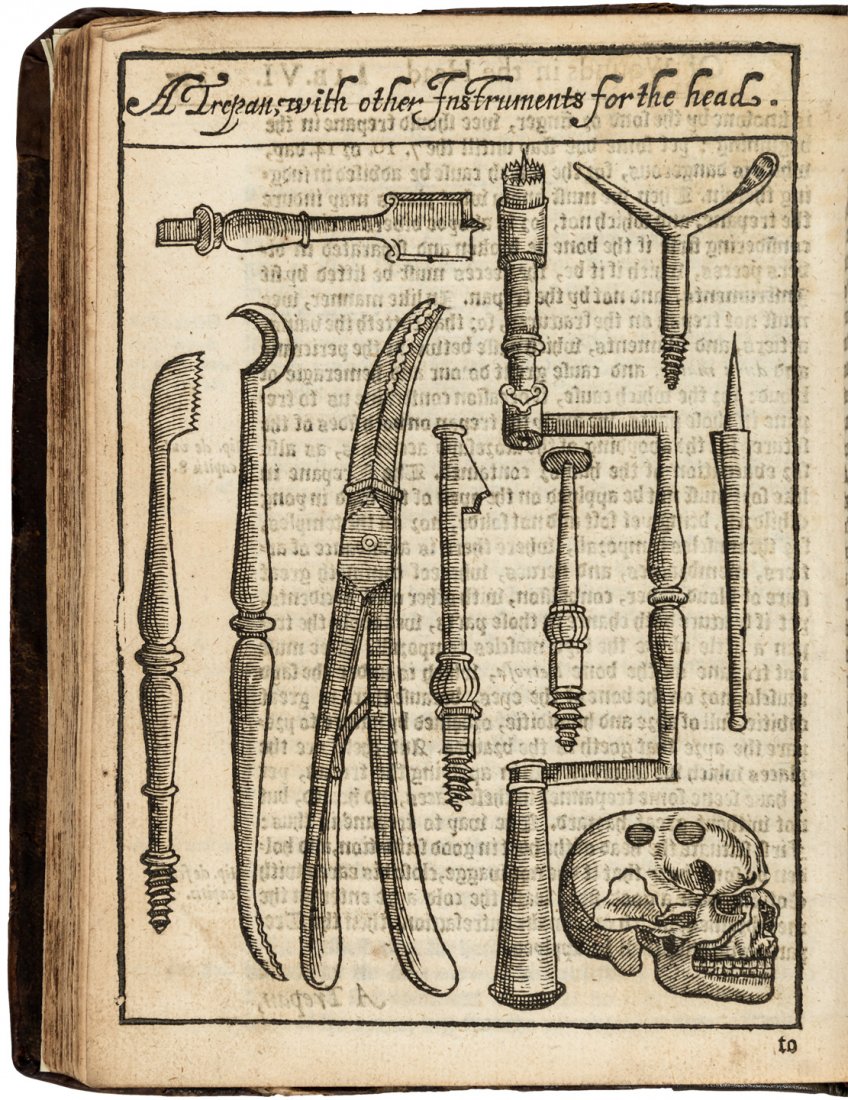 First systematic English work on surgery by Peter Lowe: Heading: Author: Lowe, Peter Title: A Discourse on the Whole Art of Chyrurgerie. Wherein is exactly set downe the definition, causes, accidents, prognostications, and cures of all sorts of diseases, b