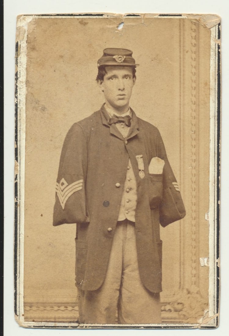 Pvt. Alfred A. Stratton CDV - Wounded & lost arms: Pvt. Alfred A. Stratton CDV - Wounded and lost his arms at Petersburg, VA. G. Co. New York 147th Infantry wounded on 6/18/1864 Carte de visite