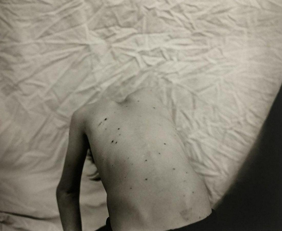 Sally Mann, Pox, 1986: Photographer: Sally Mann is an American photographer, widely known for her large-format, black-and-white photographs—at first of her young children, then later of landscapes suggesting decay and dea