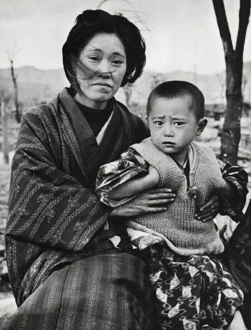ALFRED EISENSTAEDT, 1946 Hiroshima Survivor: Photographer: Alfred Eisenstaedt (German-born American, 1898 - 1995) - one of the most prolific and historically important photographers of the 20th century. Eisenstaedt achieved prominence as a photo