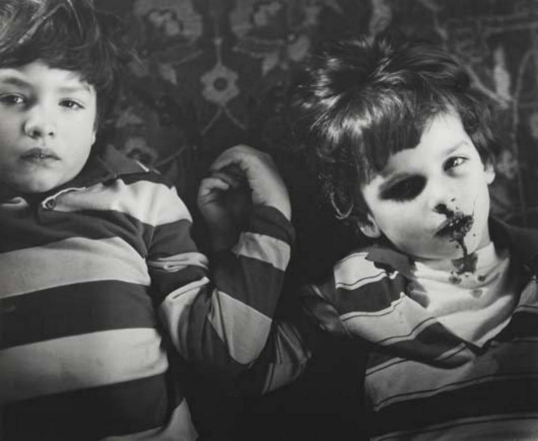 Sally Mann, Emmett's Bloody Nose, 1985: Photographer: Sally Mann is an American photographer, widely known for her large-format, black-and-white photographs—at first of her young children, then later of landscapes suggesting decay and dea