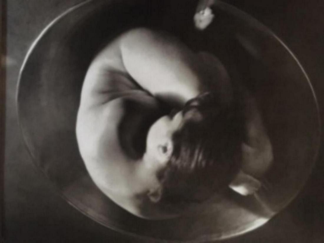 Ruth Bernhardt, embryo, 1934 (1 of 1)