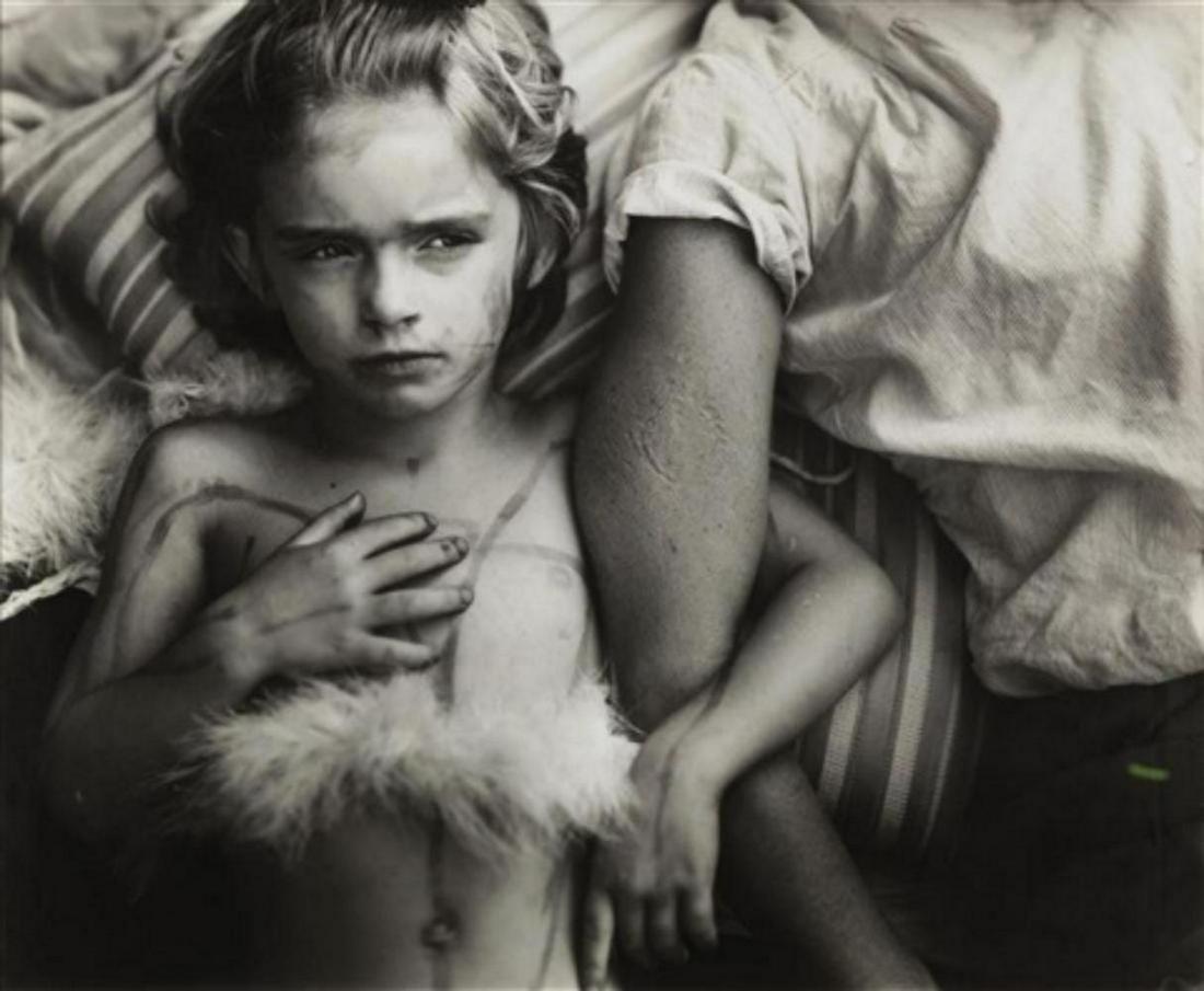 SALLY MANN - Jessie bites , 1985: Photographer: Sally Mann is an American photographer, widely known for her large-format, black-and-white photographs at first of her young children, then later of landscapes suggesting decay and death