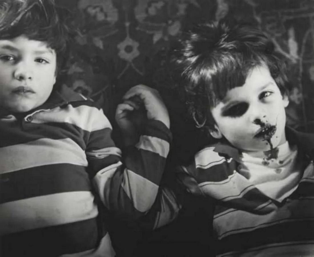 Sally Mann, Emmett's Bloody Nose, 1985: Photographer: Sally Mann is an American photographer, widely known for her large-format, black-and-white photographs at first of her young children, then later of landscapes suggesting decay and death