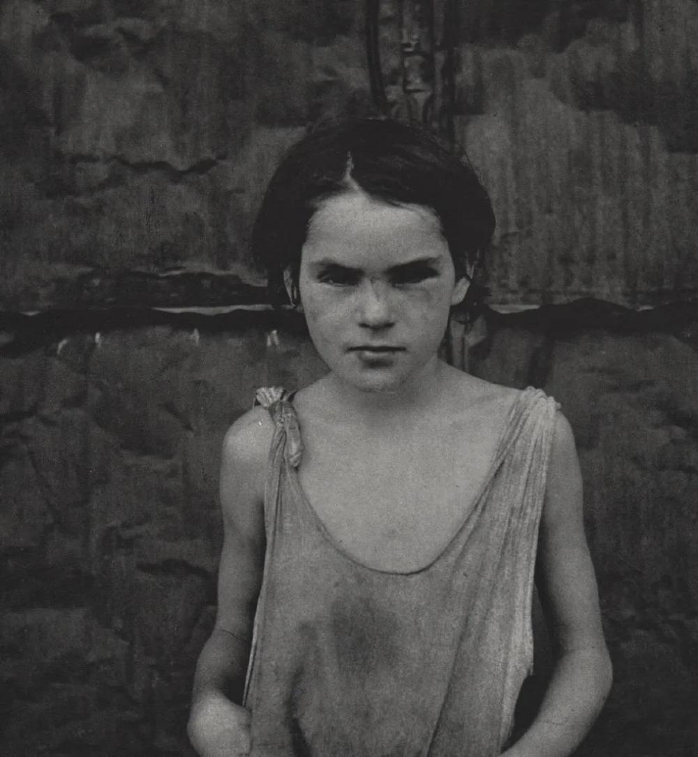 Dorothea Lange, Damaged Child, Shacktown, Elm Grove, Oklahoma, 1936: Photographer: Dorothea Lange (1896-1965) was an American documentary photographer and photojournalist, best known for her Depression-era work for the Farm Security Administration. Subject/Title: Damag